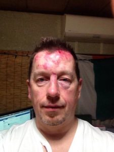 7 Japanese thugs attacked me on my way home from a party.